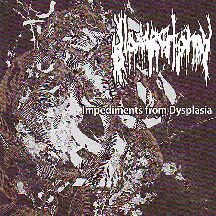 Glossectomy - "Impediments From Dysplasia"