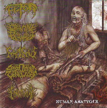 Cover for Fetor / Cranial Blowout / Feto in Fetus / Splattered Genocide / Goremitory – Human Abbatoir