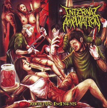 Cover for Internal Amputation - Abortus Iminens