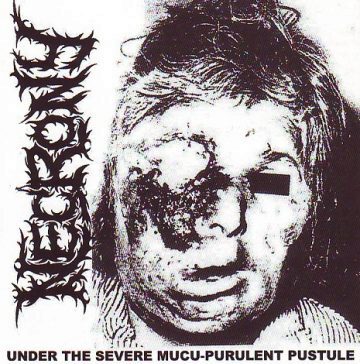 Cover for Necrony - Under the Severe Mucu - Purulent Pustule