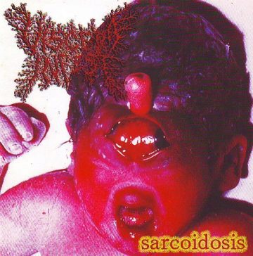 Cover for Viscera Infest - Sarcoidosis