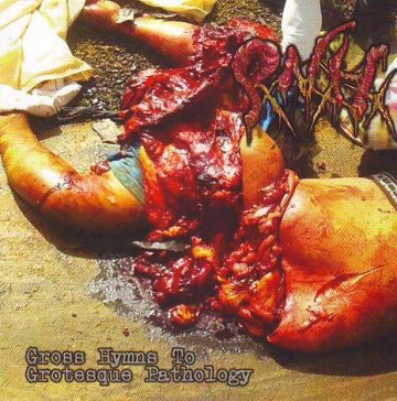 Cover for Pancreatite Necro Hemorrgica - Gross Hymns To Grotesque Pathology