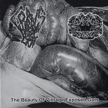 Cover for Corpus Luteum Cyst / Lymphatic Filariasis - The Beauty Of Vintage Exposed Guts