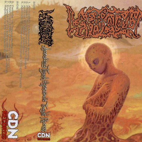 Laparotomy – Ascendancy Through Hypnagogic Thought Process (Cassette)