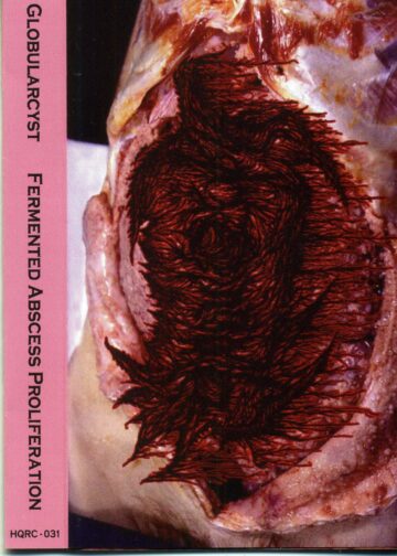 Cover for Globularcyst – Fermented Abscess Proliferation (Cassette)