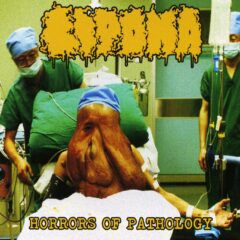 Cover for Lipoma - Horrors of Pathology