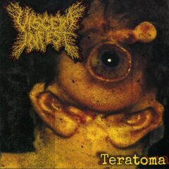 Cover for Viscera Infest - Teratoma