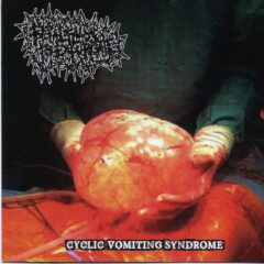 Cover for Foetal Fluids To Expurgate - Cyclic Vomiting Syndrome