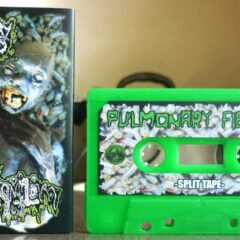 Pulmonary Fibrosis / Vomitoma - Split (Cassette)